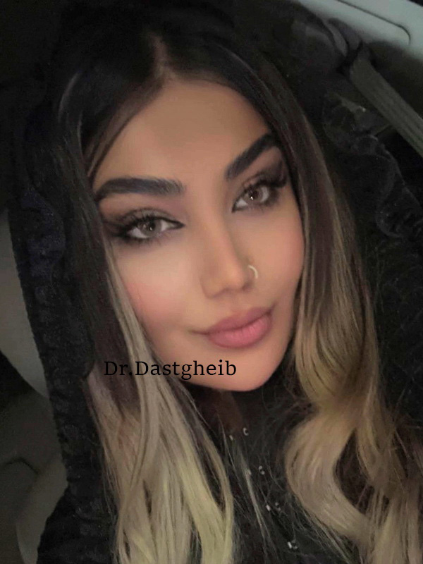 لیفت اندوسکوپیک ابرو و شقیقه