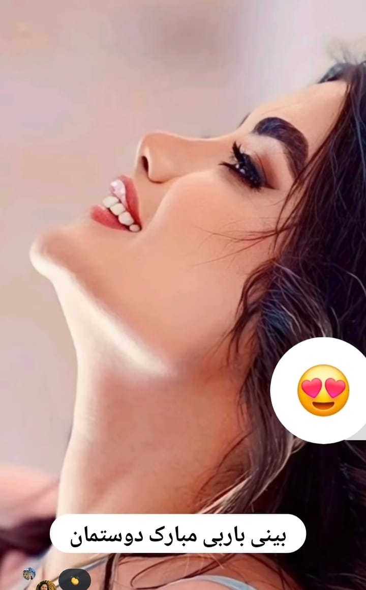 پروجکشن مناسب بینی فانتزی با قوس ملایم جراحی دکتر دستغیب در شیراز