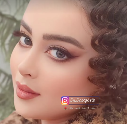 نتیجه طبیعی و ماندگار جراحی بینی متناسب با چهره