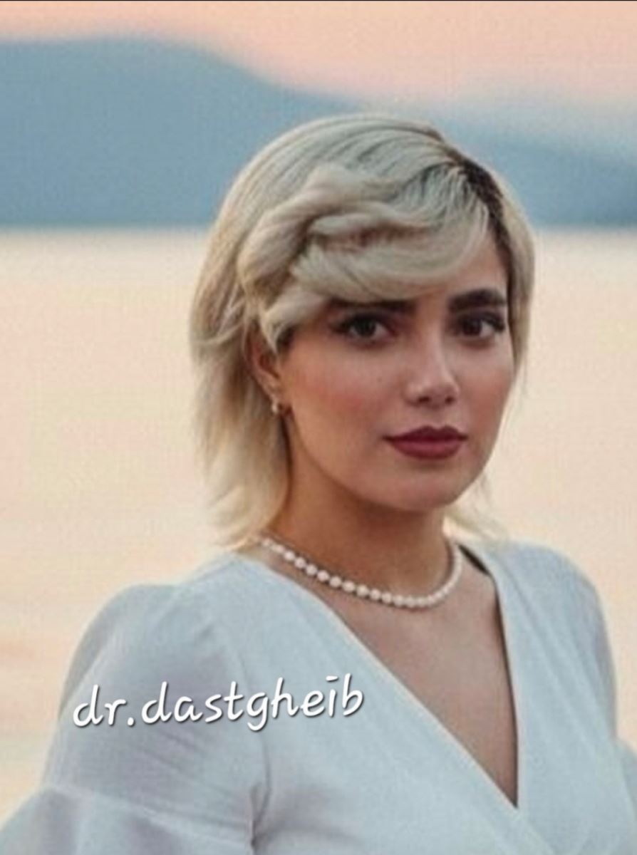 نمونه جراحی بینی طبیعی با حفظ تناسب و هویت چهره توسط دکتر دستغیب در شیراز