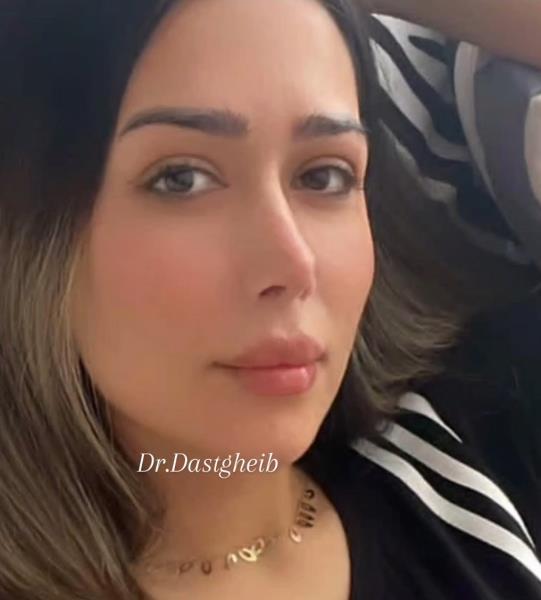 اهمیت و نحوه  شستشوی بینی بعد از عمل؛ کاهش التهاب، بهبود سینوس‌ها و تنفس بهتر