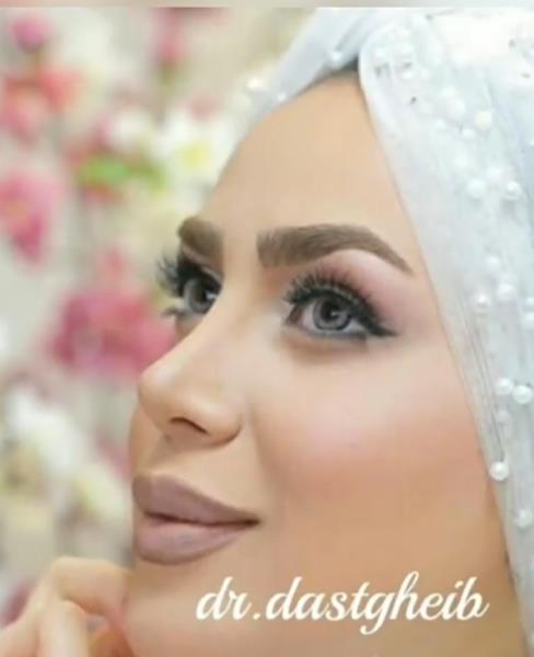 انتخاب بهترین جراح بینی برای ایجاد قرینگی، ظرافت و زیبایی