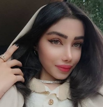 نتیجه جراحی بینی فانتزی توسط دکتر دستغیب در شیراز
